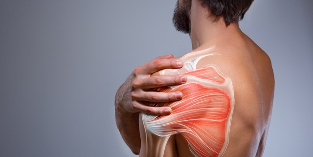 Rotator cuff baksida